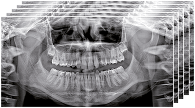 NewTom 2D/3D GO – Компьютерный томограф