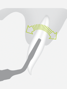 W&H EX1 — Насадка для атравматичного удаления зубов, сохраняет альвеолярную кость