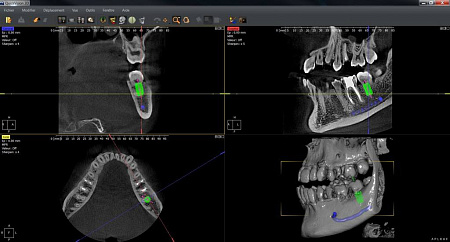 Owandy I-Max Touch 3D Ceph – Конусно-лучевой томограф 9х8