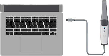 Eighteeth Helios 600 — Интраоральный сканер