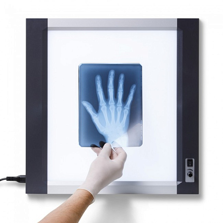 Армед Негатоскоп диодный - однокадровый