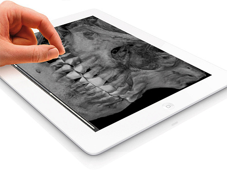 FONA XPan 3D - рентгенографическая цифровая система панорамной съемки